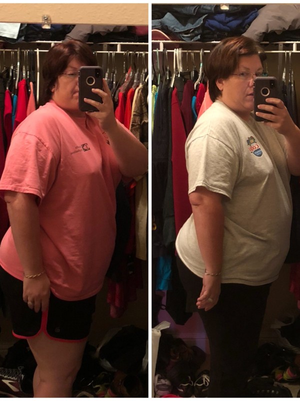Kimberly's Weight Loss Before and After