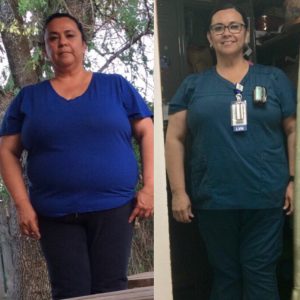 Elsa lost 40 Lbs before and after