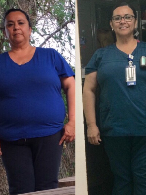 Elsa lost 40 Lbs before and after
